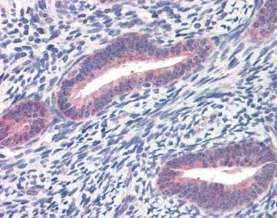Immunohistochemistry-Paraffin: Twist-1 Antibody [NB120-49254]