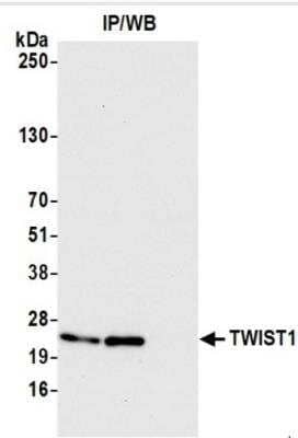 Immunoprecipitation: Twist-1 Antibody (BLR156J) [NBP3-14732]