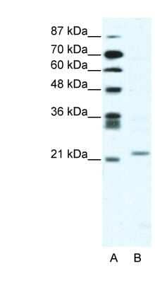 Western Blot: Twist-1 Antibody [NB120-49254]
