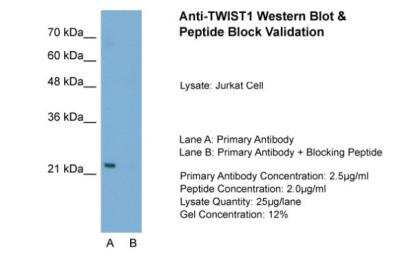 Western Blot: Twist-1 Antibody [NB120-49254]