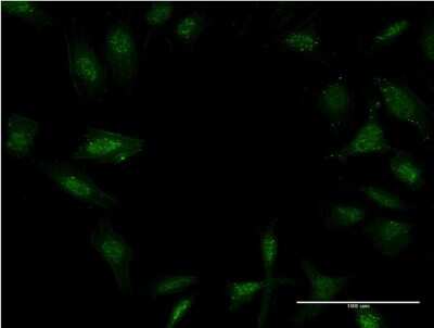 Immunocytochemistry/ Immunofluorescence: Twist-2 Antibody (1E2) [H00117581-M06]
