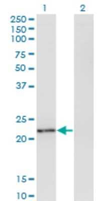 Western Blot: Twist-2 Antibody (1E2) [H00117581-M06]