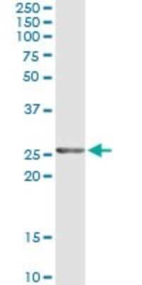Immunoprecipitation: Twist-2 Antibody (3C12) [H00117581-M12]