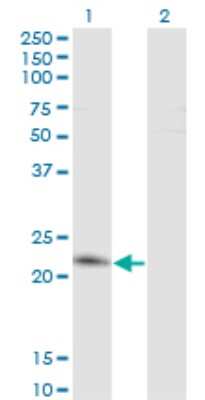 Western Blot: Twist-2 Antibody (3C12) [H00117581-M12]