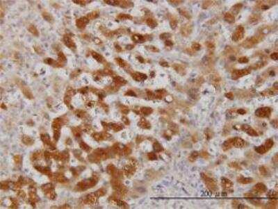 Immunohistochemistry-Paraffin: Twist-2 Antibody (3C8) [H00117581-M01]