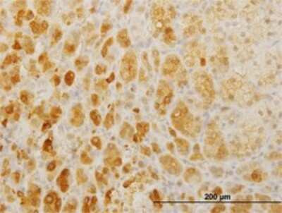Immunohistochemistry-Paraffin: Twist-2 Antibody (3C8) [H00117581-M01]