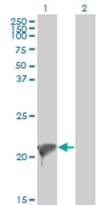 Western Blot: Twist-2 Antibody (3C8) [H00117581-M01]