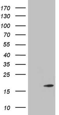 Western Blot: Twist-2 Antibody (OTI6H10) [NBP2-46255]