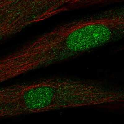 Immunocytochemistry/ Immunofluorescence: Twist-2 Antibody [NBP2-56209]