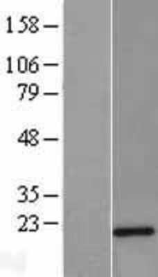 Western Blot: Twist-2 Overexpression Lysate [NBL1-17460]