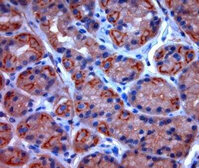 Immunohistochemistry-Paraffin: Two pore calcium channel protein 2 Antibody - Azide and BSA Free [NBP1-30670]