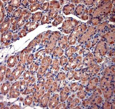 Immunohistochemistry-Paraffin: Two pore calcium channel protein 2 Antibody - Azide and BSA Free [NBP1-30670]