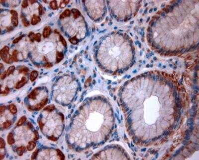 Immunohistochemistry-Paraffin: Two pore calcium channel protein 2 Antibody - Azide and BSA Free [NBP1-30670]