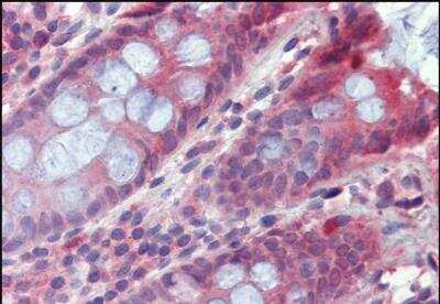 Immunohistochemistry-Paraffin: Two pore calcium channel protein 2 Antibody [NBP1-45234]