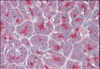 Immunohistochemistry-Paraffin: Two pore calcium channel protein 2 Antibody [NBP1-45234]