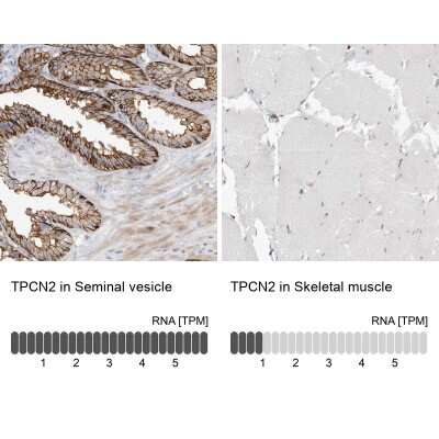 Immunohistochemistry-Paraffin: Two pore calcium channel protein 2 Antibody [NBP1-86923]