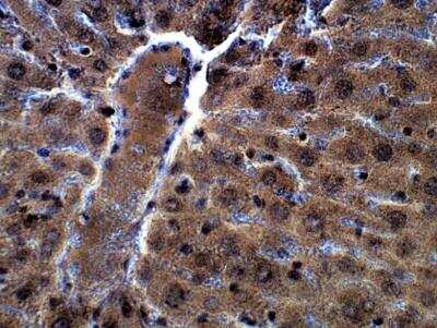Immunohistochemistry-Paraffin: Two pore calcium channel protein 2 Antibody [NBP3-12360]