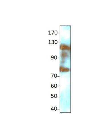 Western Blot: Two pore calcium channel protein 2 Antibody [NBP3-12360]