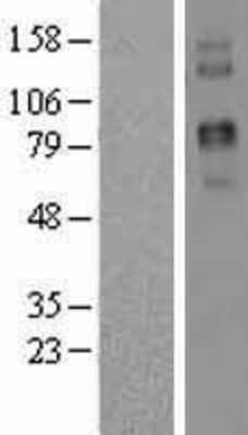 Western Blot: Two pore calcium channel protein 2 Overexpression Lysate [NBL1-17211]