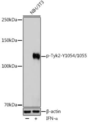 Western Blot: Tyk2 [p Tyr1055, p Tyr1054] AntibodyBSA Free [NBP3-16896]