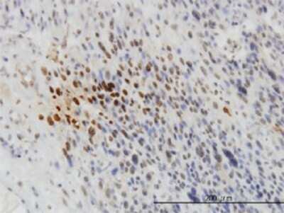 Immunohistochemistry-Paraffin: Tyk2 Antibody (5A4) [H00007297-M02]