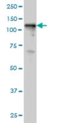 Western Blot: Tyk2 Antibody (5A4) [H00007297-M02]