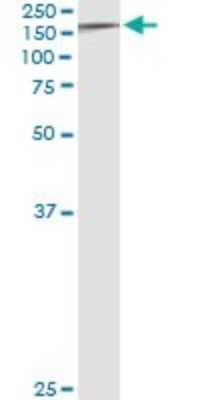 Immunoprecipitation: Tyk2 Antibody (6G12) [H00007297-M01]