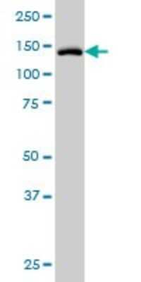 Western Blot: Tyk2 Antibody (6G12) [H00007297-M01]