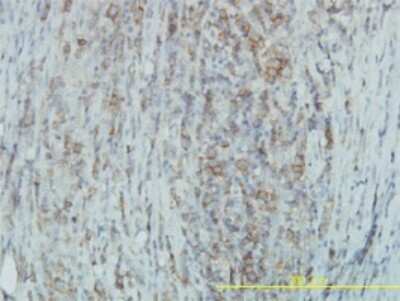 Immunohistochemistry-Paraffin: Tyk2 Antibody (6H1) [H00007297-M03]