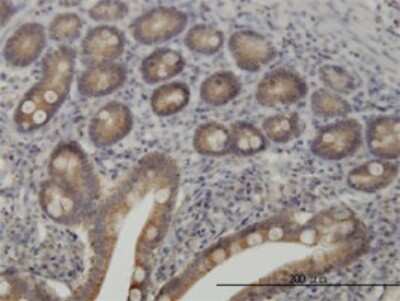 Immunohistochemistry-Paraffin: Tyk2 Antibody (6H1) [H00007297-M03]