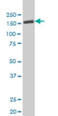 Western Blot: Tyk2 Antibody (6H1) [H00007297-M03]