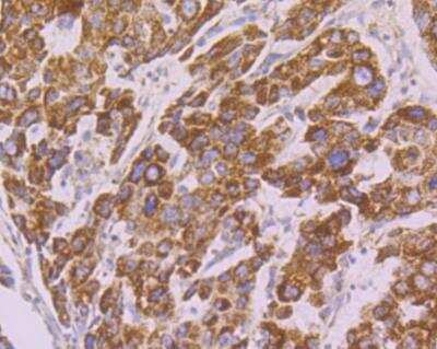 Immunohistochemistry: Tyk2 Antibody [NBP2-76968]