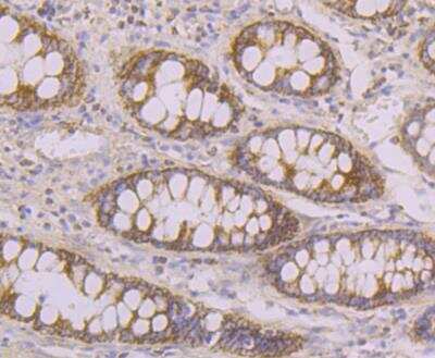 Immunohistochemistry: Tyk2 Antibody [NBP2-76968]