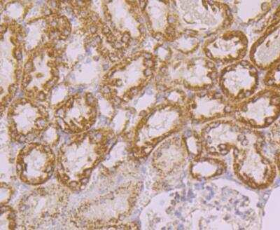Immunohistochemistry: Tyk2 Antibody [NBP2-76968]