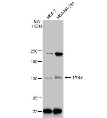 Western Blot: Tyk2 Antibody [NBP1-32450]