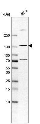 Western Blot: Tyk2 Antibody [NBP1-87825]