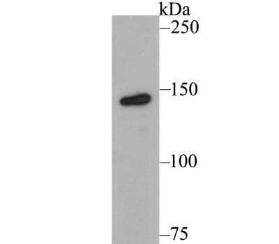 Western Blot: Tyk2 Antibody [NBP2-76968]