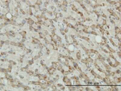 Immunohistochemistry-Paraffin: Tyrosinase Antibody (2A2-F4) [H00007299-M01]