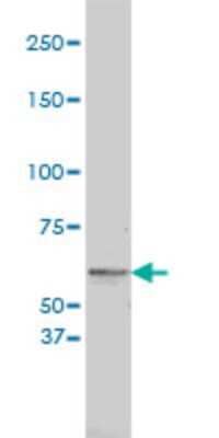 Western Blot: Tyrosinase Antibody (2A2-F4) [H00007299-M01]