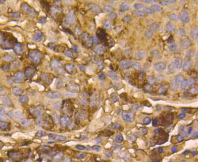 Immunohistochemistry-Paraffin: Tyrosinase Antibody (C2-B5) [NBP2-67233]