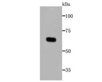 Western Blot: Tyrosinase Antibody (C2-B5) [NBP2-67233]