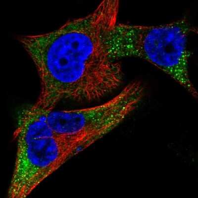 Immunocytochemistry/ Immunofluorescence: Tyrosinase Antibody [NBP2-58910]