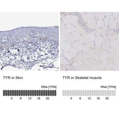 Immunocytochemistry/ Immunofluorescence: Tyrosinase Antibody [NBP3-16989]