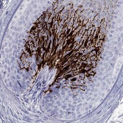 Immunohistochemistry-Paraffin: Tyrosinase Antibody [NBP3-16989]