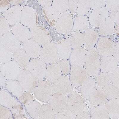Immunohistochemistry-Paraffin: Tyrosinase Antibody [NBP3-16989]