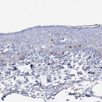 Immunohistochemistry-Paraffin: Tyrosinase Antibody [NBP3-16989]
