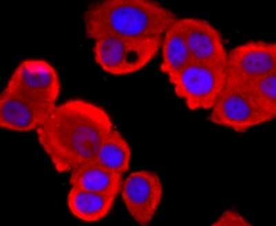 Immunocytochemistry/ Immunofluorescence: Tyrosinase Antibody (JA52-11) [NBP2-67232]