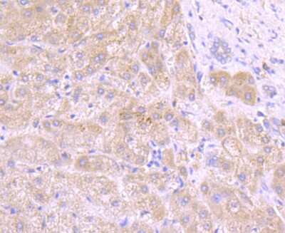 Immunohistochemistry-Paraffin: Tyrosinase Antibody (JA52-11) [NBP2-67232]