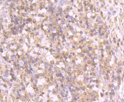 Immunohistochemistry-Paraffin: Tyrosinase Antibody (JA52-11) [NBP2-67232]