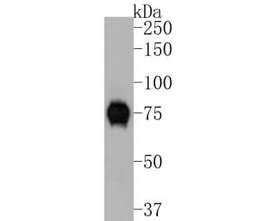 Western Blot: Tyrosinase Antibody (JA52-11) [NBP2-67232]